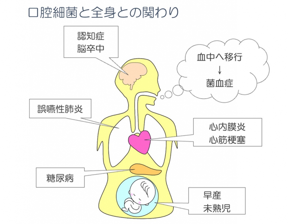 歯周病と全身との関係